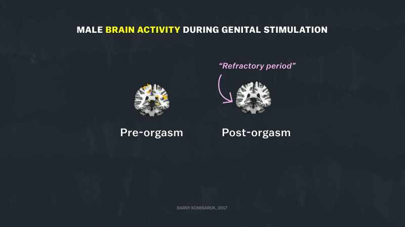 [narrator] The male brain experiences what's called a refractory period