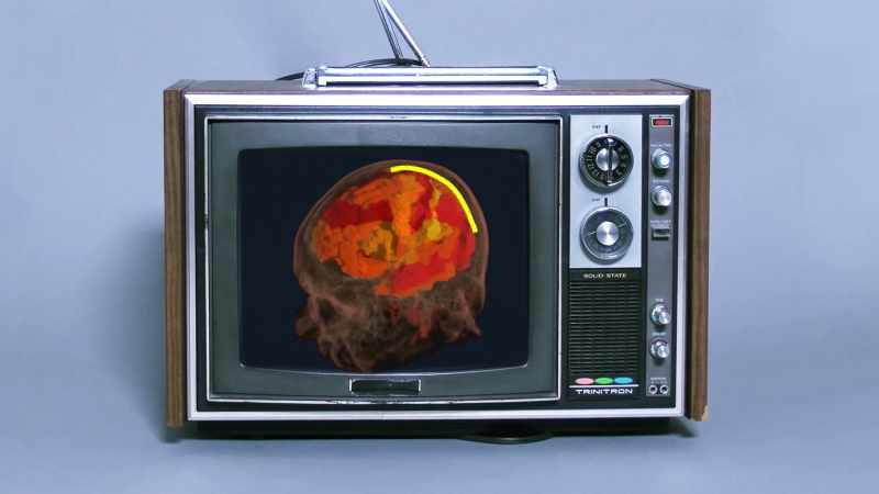 [narrator] This is your brain