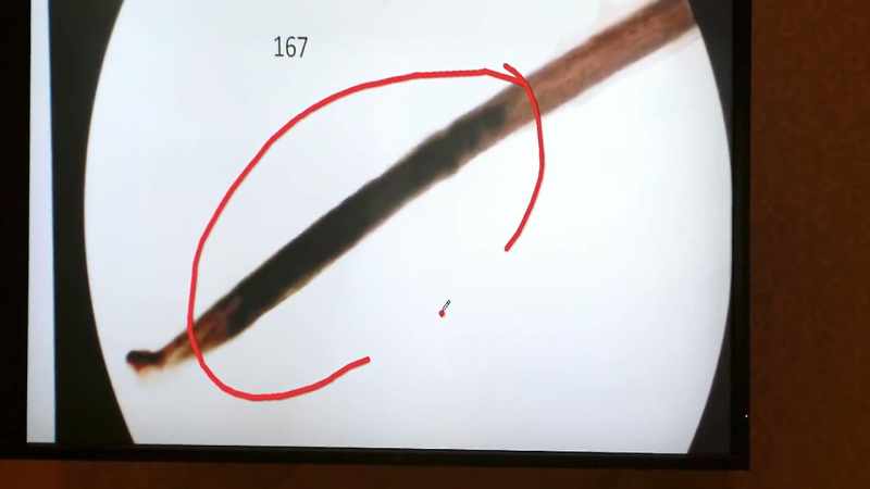 NARRATOR: When forensic experts examine the hair closer