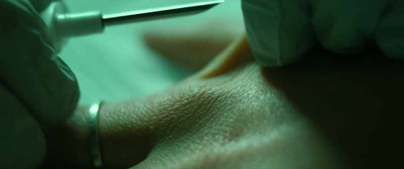 [News Reporter] A microchip implanted beneath the skin