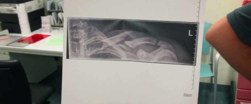 [Nick] I need surgery