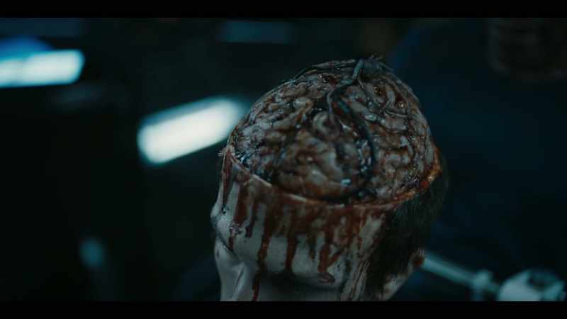 No indication that flesh has been eaten away