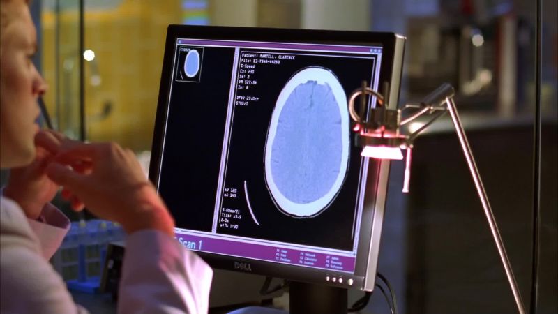 No lesions, no aneurysms
