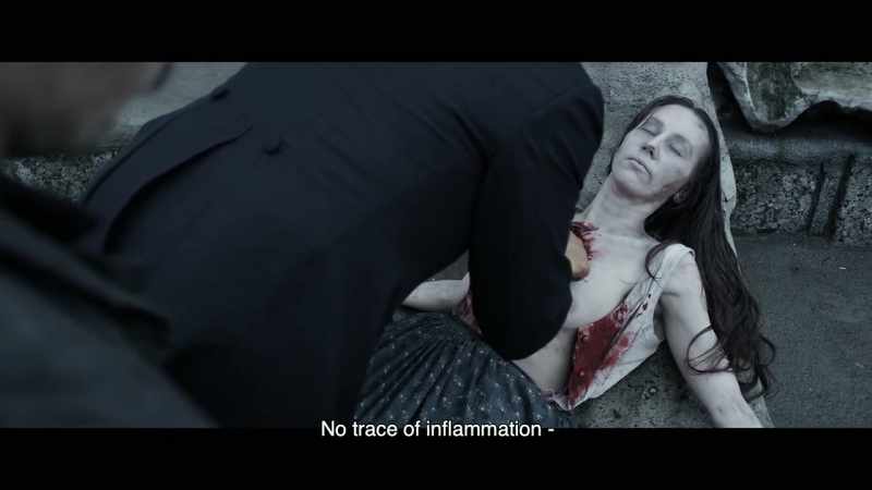 No trace of inflammation