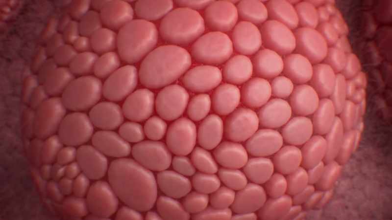 Now, sympathetic nervous system is our fight or flight response