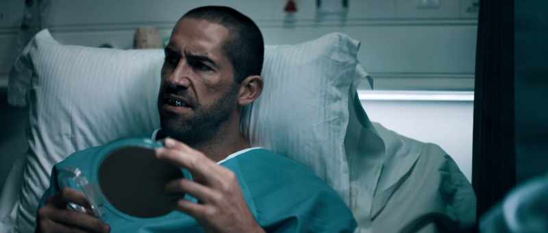 Now, they would've given you the normal dentures if you just asked
