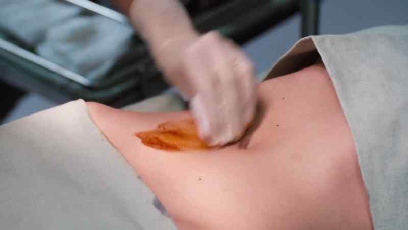 NURSE: She has an inny