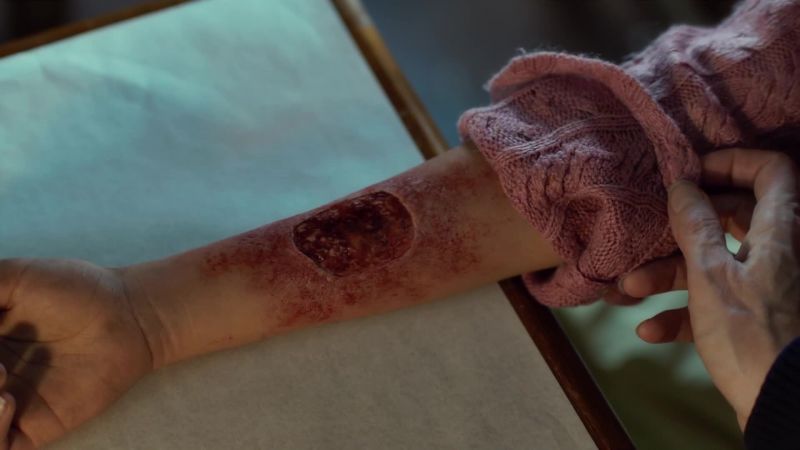 Oh, good Lord. She told me it doesn't hurt
