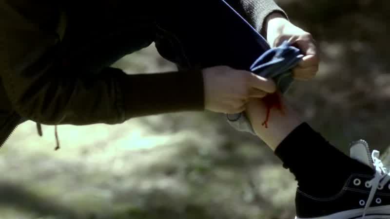 Oh! Look at that. That is not pretty. You ok? You should go. Take care of that. Really, it's nothing