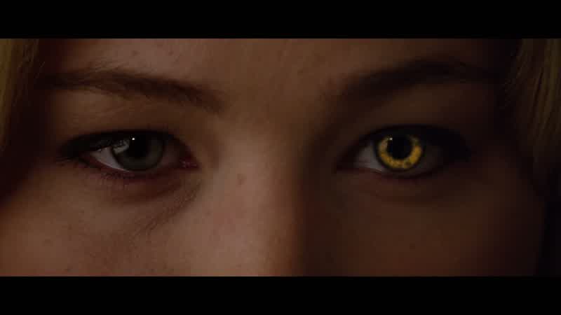 Oh, look, you have heterochromia, too