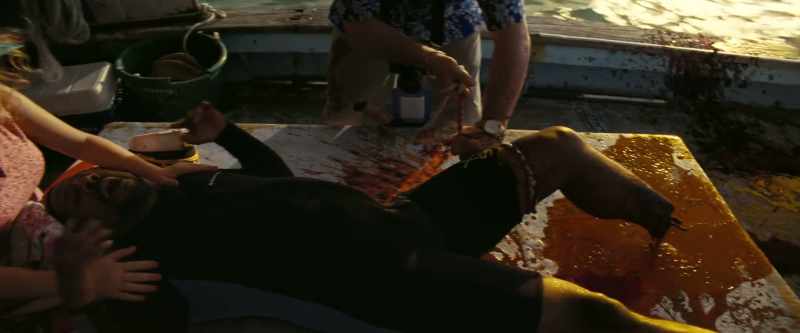 Oh, Lord! - Just a flesh wound. Don't worry!