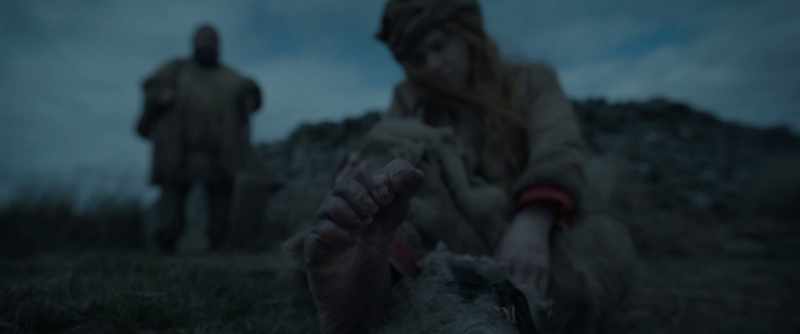 Oh, my toes, they look like boxers' eyelids!