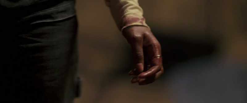 OK, I'm gonna untie him... Get him on his side