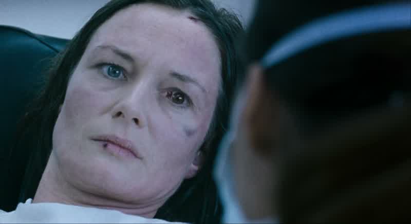 Okay. Just going to take a blood sample. It won't hurt