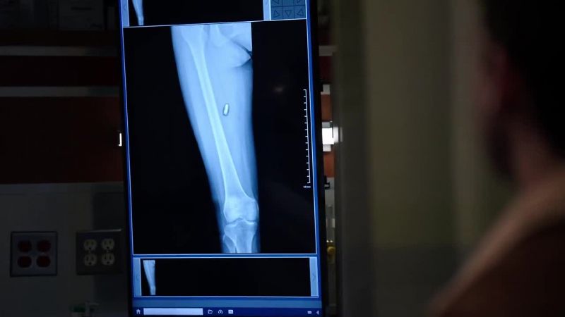 Okay, Mr. Mehti, it looks like the bullet