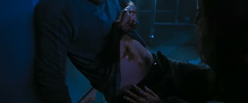 Okay. Okay, we need to... - Oh, shit... Find something. Here. Here! Just put pressure on it. Hold