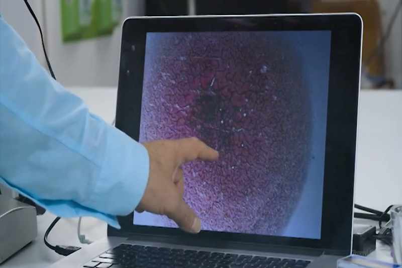 One device Dr. Migalko uses is the bioelectric scan