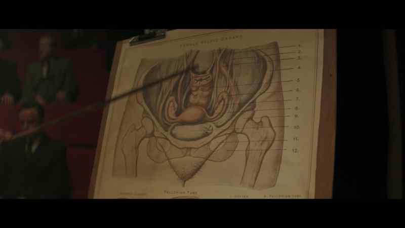 Opening the abdomen with a large cut... here