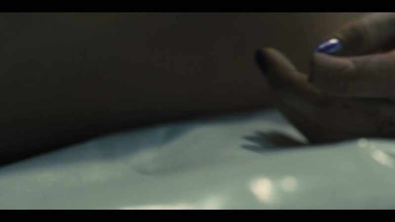 Or not long after. -What about the missing finger?