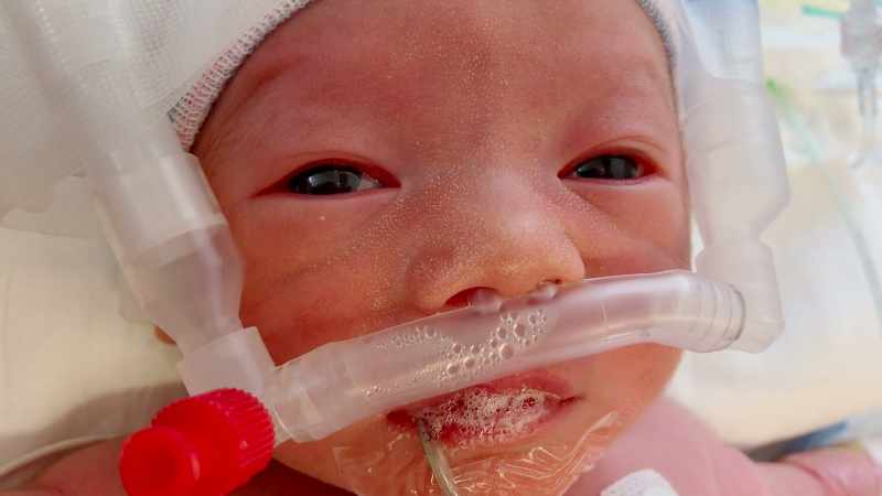 Our baby was born seven weeks early