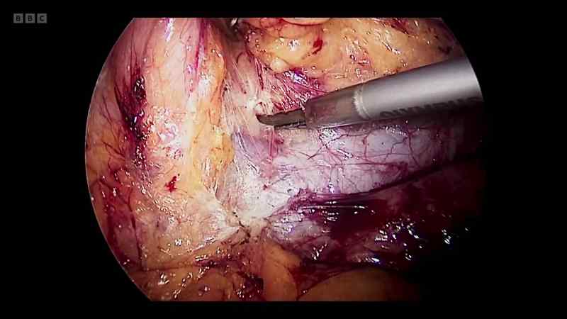 Our organs are so gory