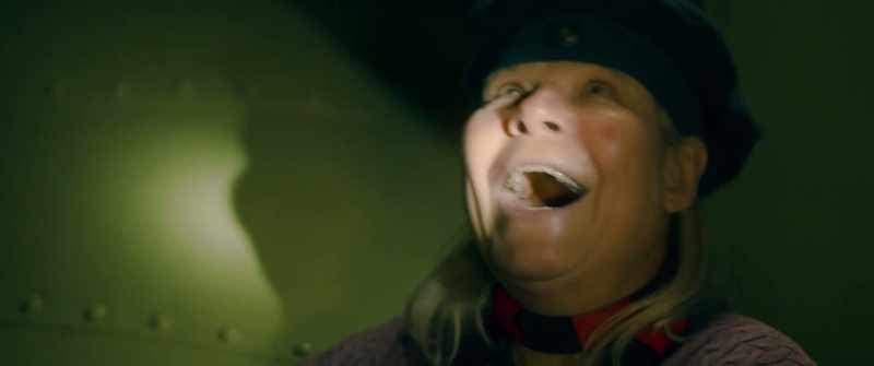 Ow! [laughs]