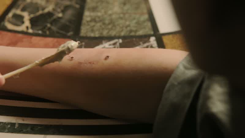 Ow! - Please, it's nearly healed. - It's ugly. - A king should have scars