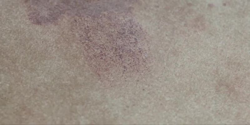 Partial shoeprint in the blood