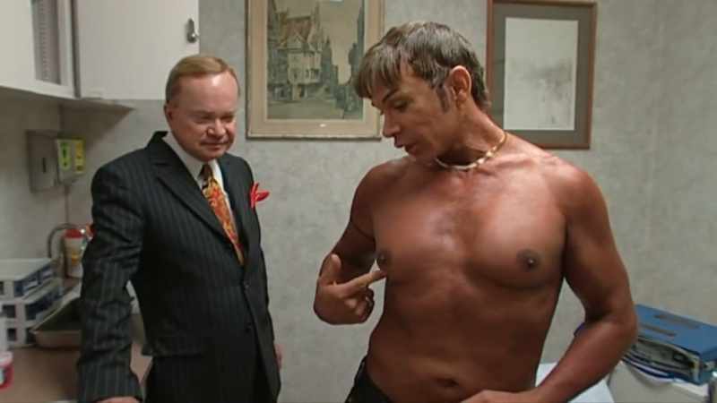 Pectoral implants, bicep implants
