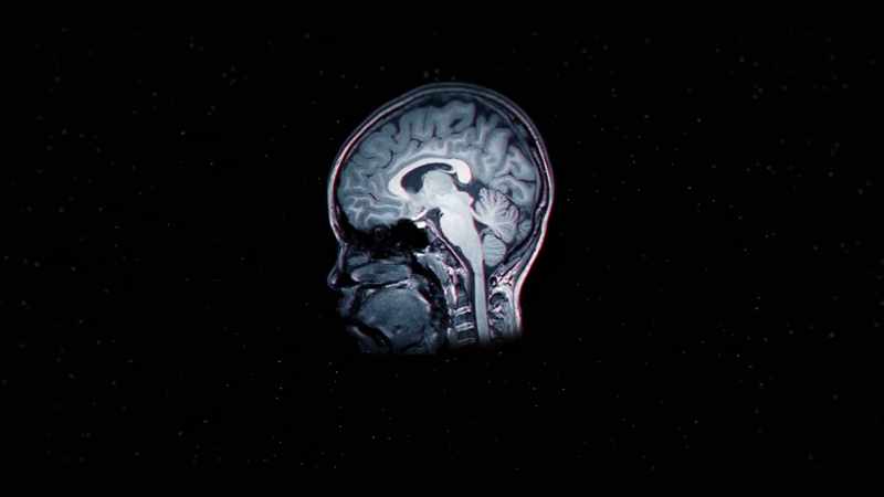 People also suggest lack of oxygen to the brain