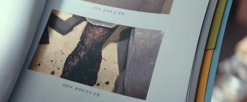 (Photo 10. Suspect's palm tattoo)