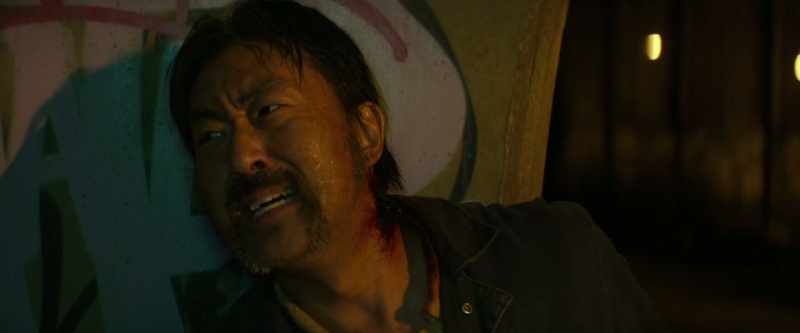 Please! I got a hole in my neck, man!