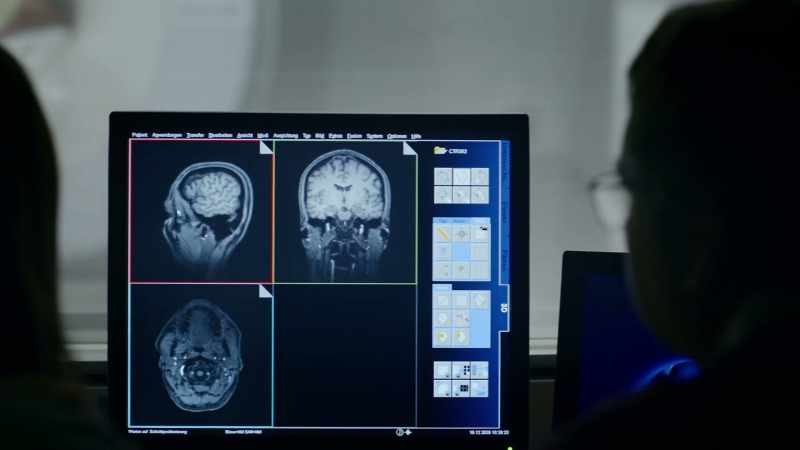 Please show me the front part of the hippocampus