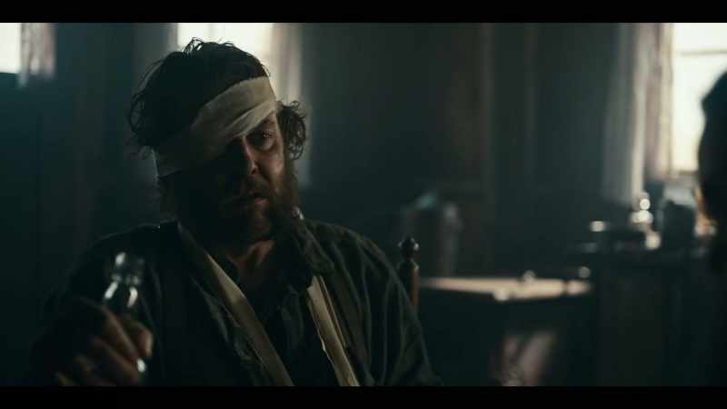 Poor Norm? What about me? Nearly lost my eye