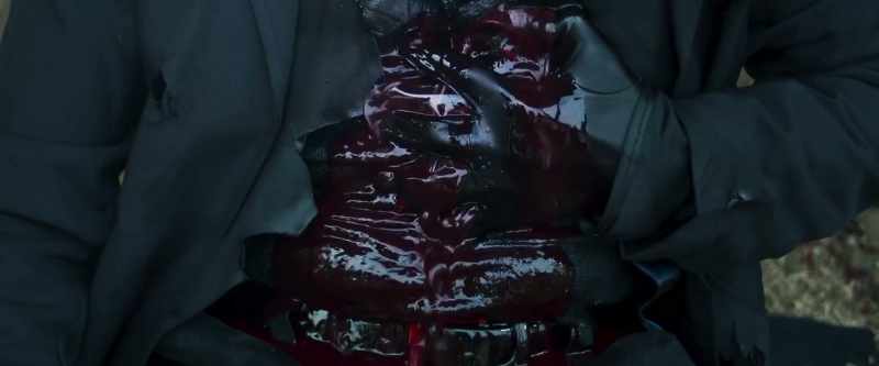 (Prefect Lukon groans) (blood trickling)