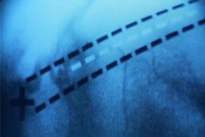 Pressure in a blood vessel. How long ago?