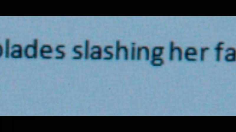 Razors slashing her face -- Huh. No