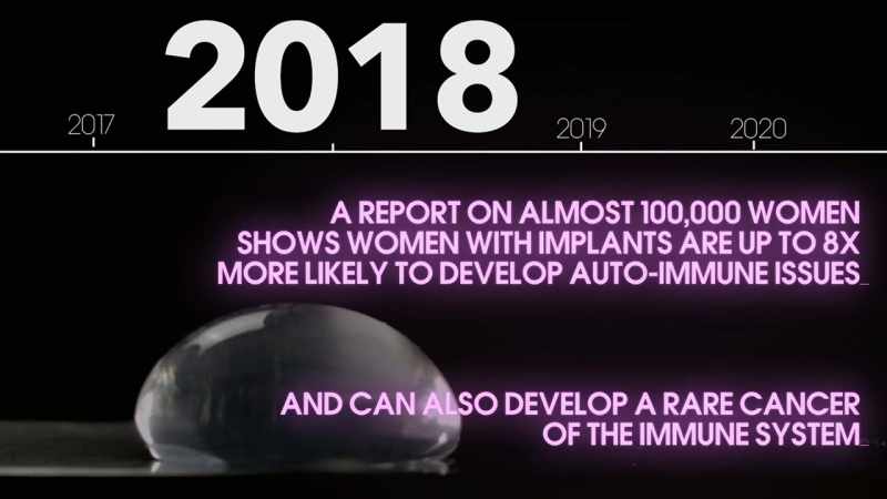 [Reporter] A report just released from MD Anderson