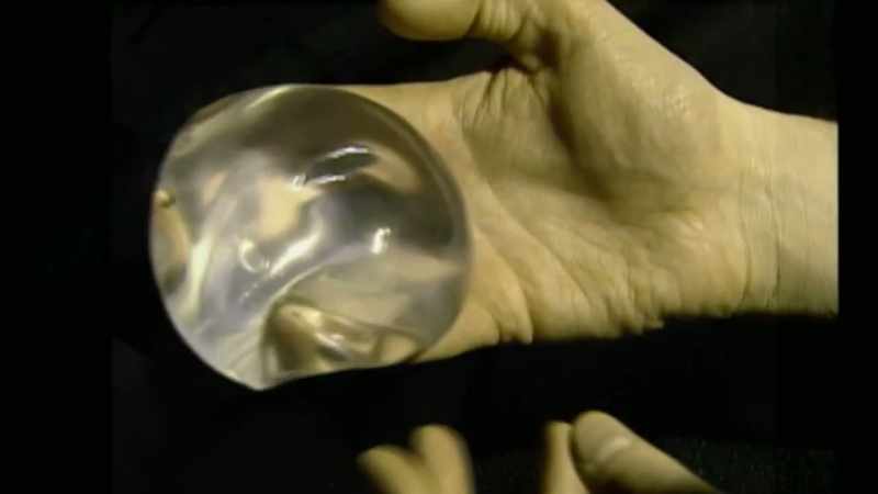 [Reporter] Recent studies say there's no link