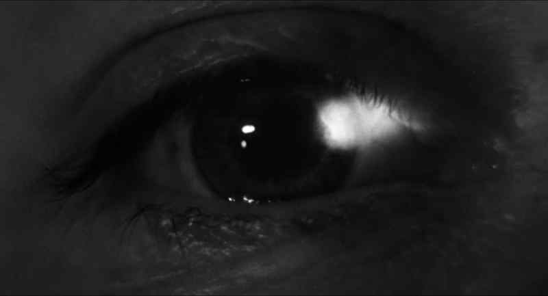 Retina