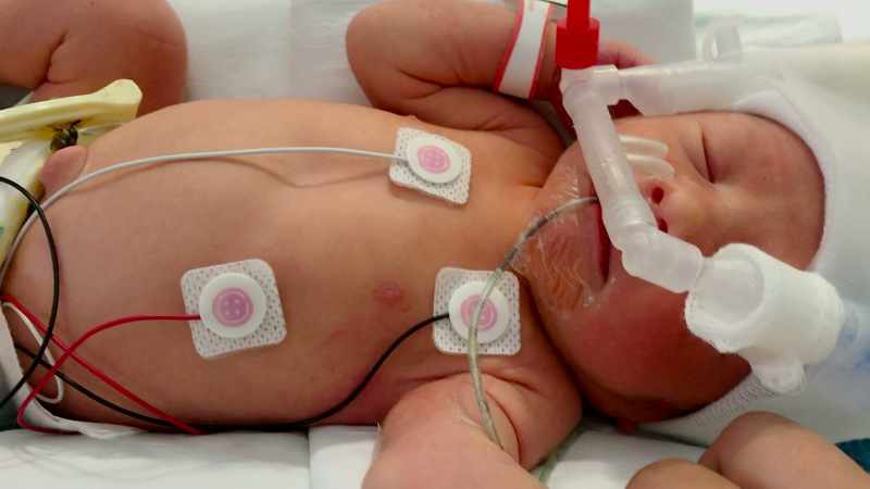 Right after he was born