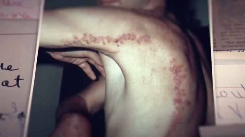 RODNEY: There was 485 stitches in my chest