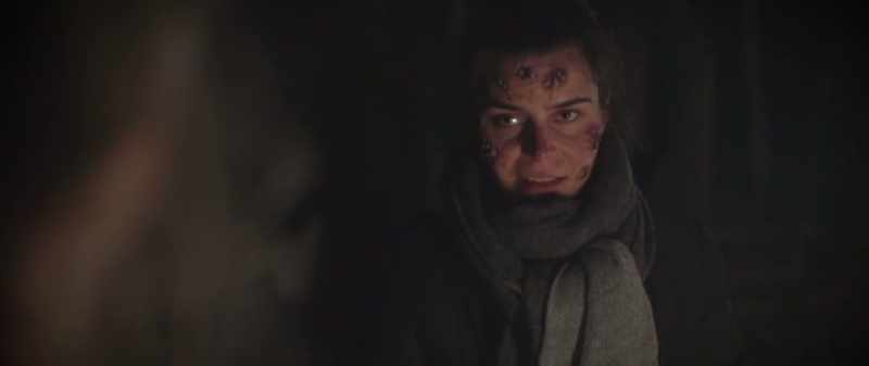 Scabs, they gassed us, we all got infected
