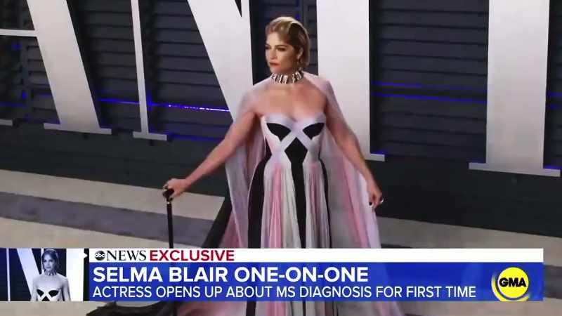 Selma revealing her multiple sclerosis diagnosis last October