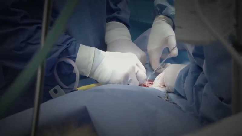 Several days ago, eebi had fairly major surgery