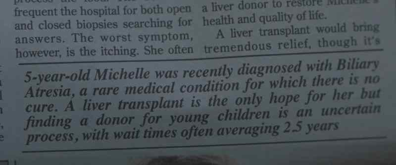 SHARON: Liver transplant