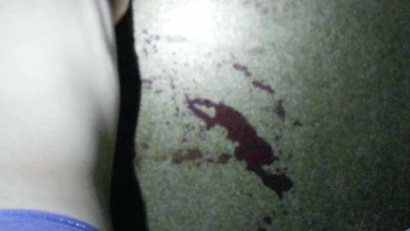 She had been shot \hnumerous times