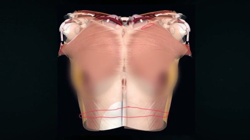 She was disarticulated at the kneecaps