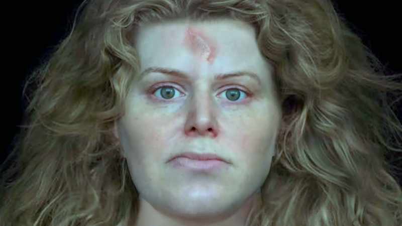 She probably would have had quite a nice scar