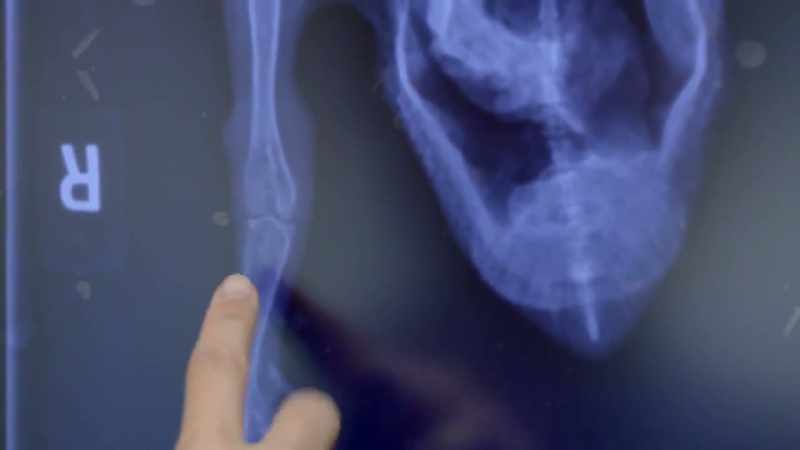 She took the initial x-ray